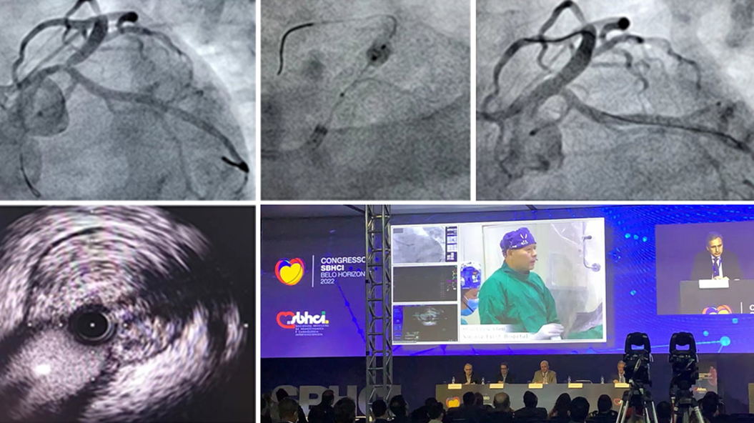 Excellent live case presentation at SBHCI 2022